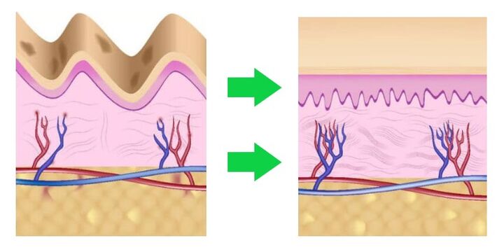 Intenskin coordinates the skin