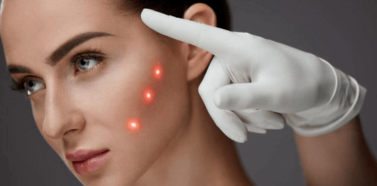 Facial skin rejuvenation beauty