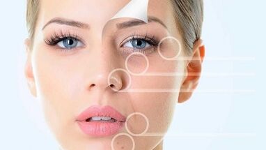 Rejuvenation of the face