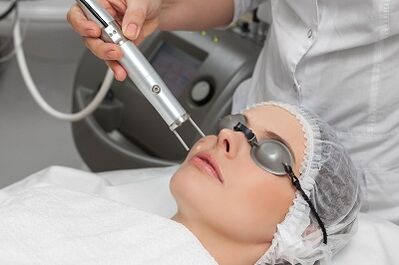 Benefits of laser skin rejuvenation